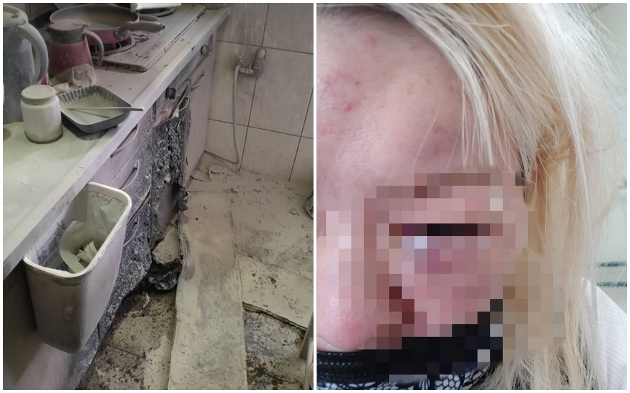 才指控遭婆婆咬傷，前空姐今（11日）竟涉嫌縱火燒傷丈夫。（翻攝畫面）