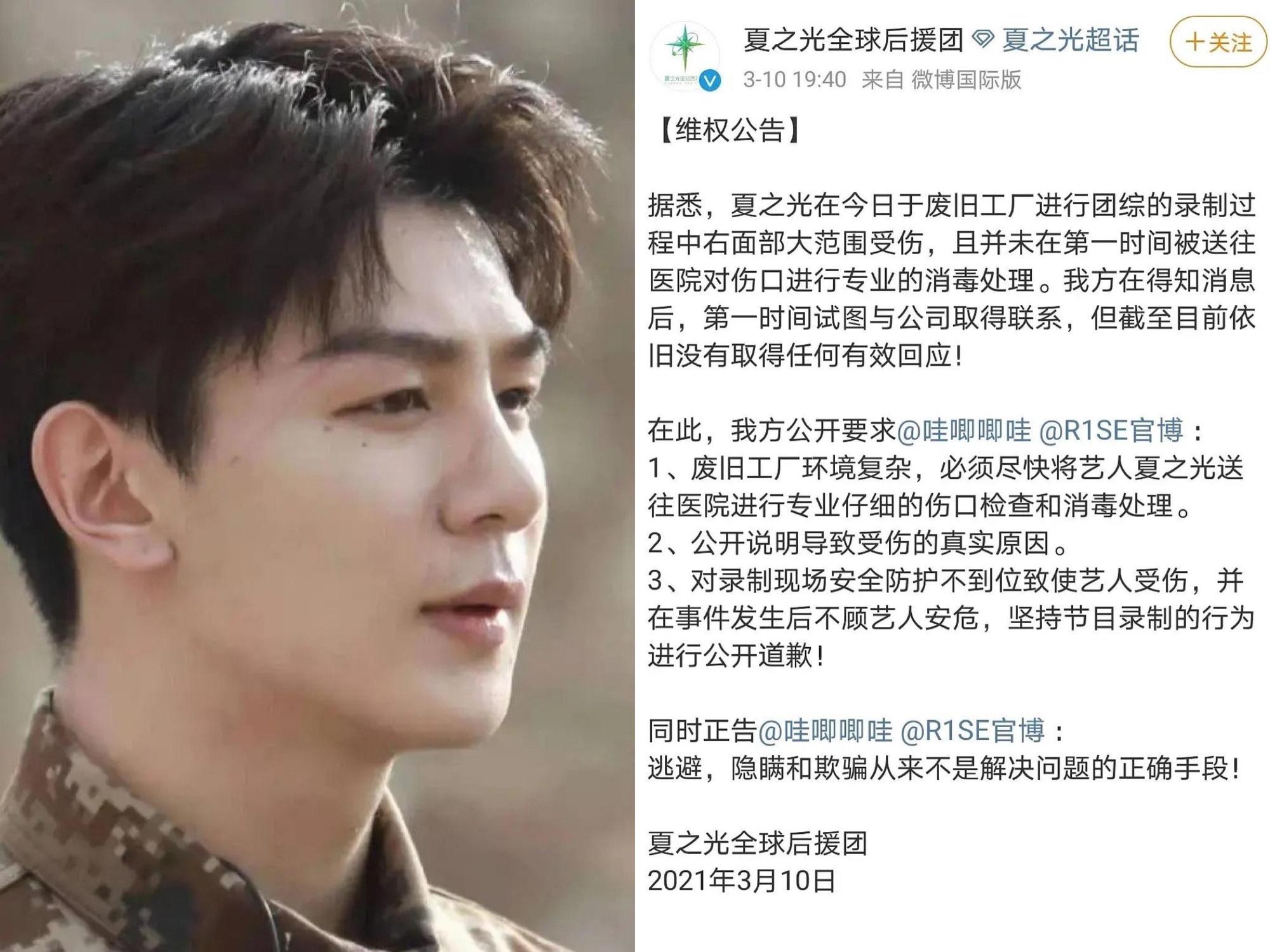夏之光傳出拍攝綜藝節目導致臉部受傷。(翻攝自夏之光全球後援團微博)