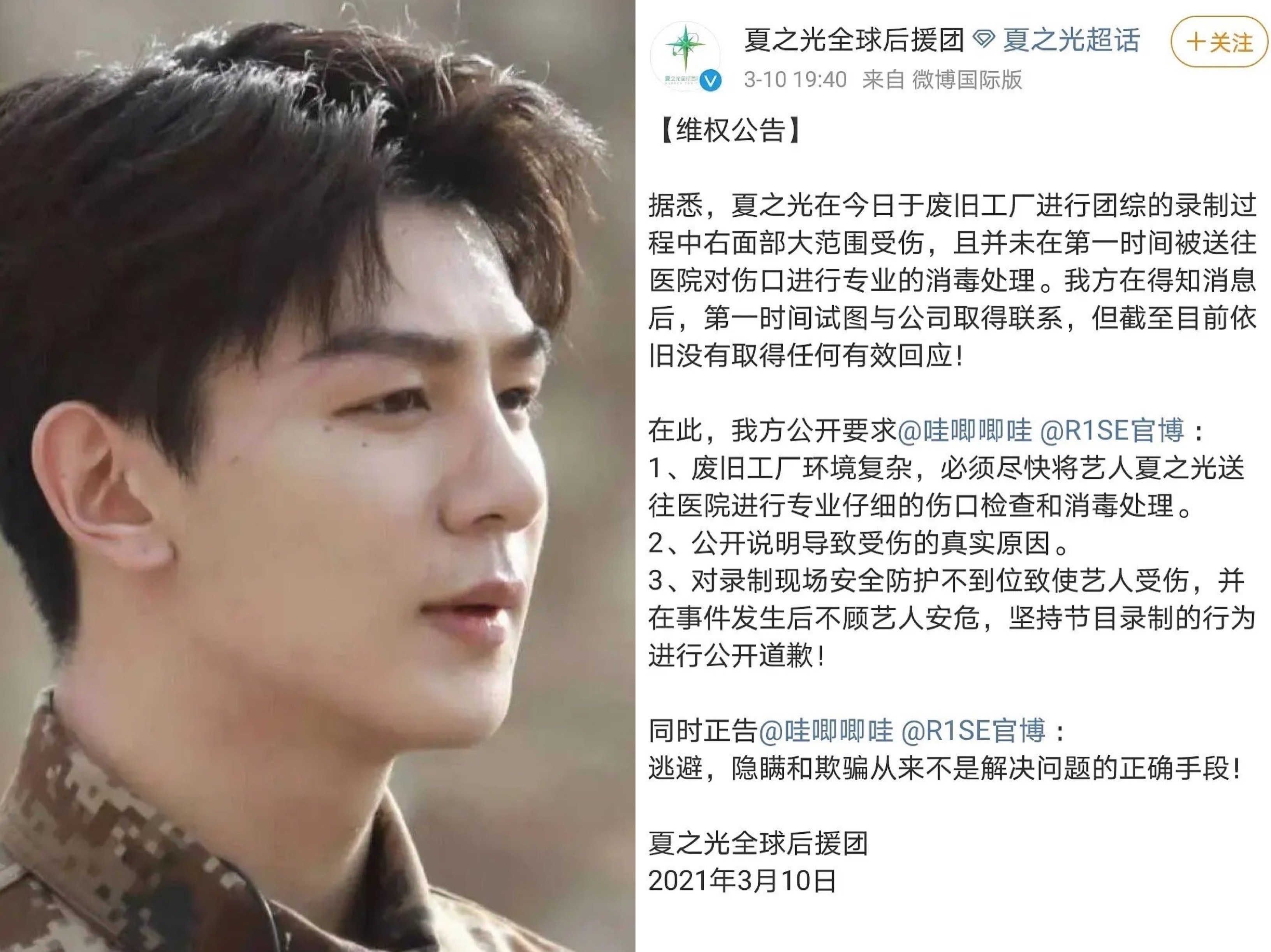 夏之光傳出拍攝綜藝節目導致臉部受傷。（翻攝自夏之光全球後援團微博）