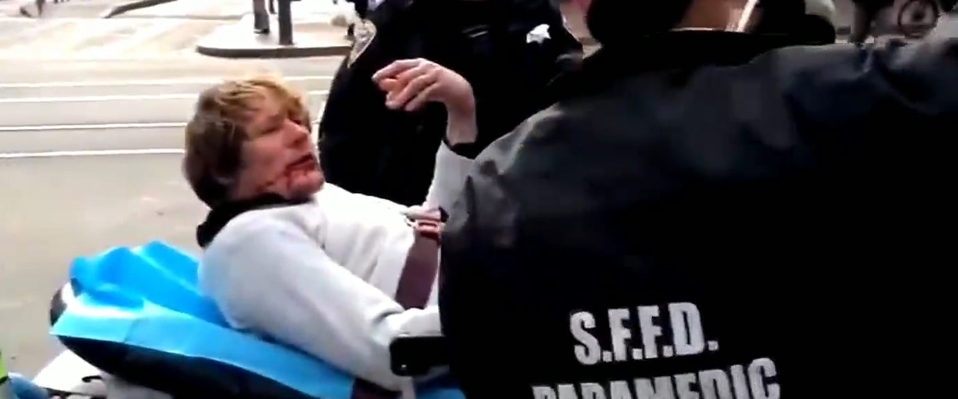 白人男子襲擊亞裔老奶奶，被老奶奶奮力還擊，最後被抬上擔架送醫。（翻攝自CBS舊金山頻道）