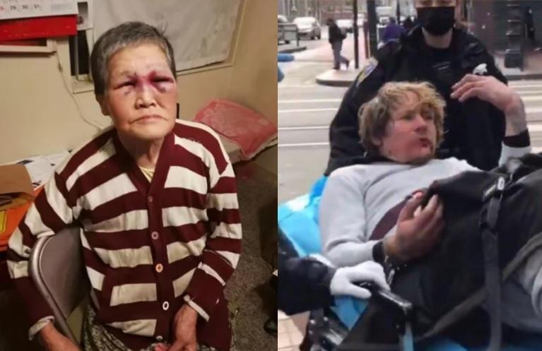 遭攻擊的亞裔老奶奶目前仍在療傷中,但她已決定要將募得的善款全數捐出打擊種族歧視。(翻攝自網路募款平台「GoFundMe」、推特)
