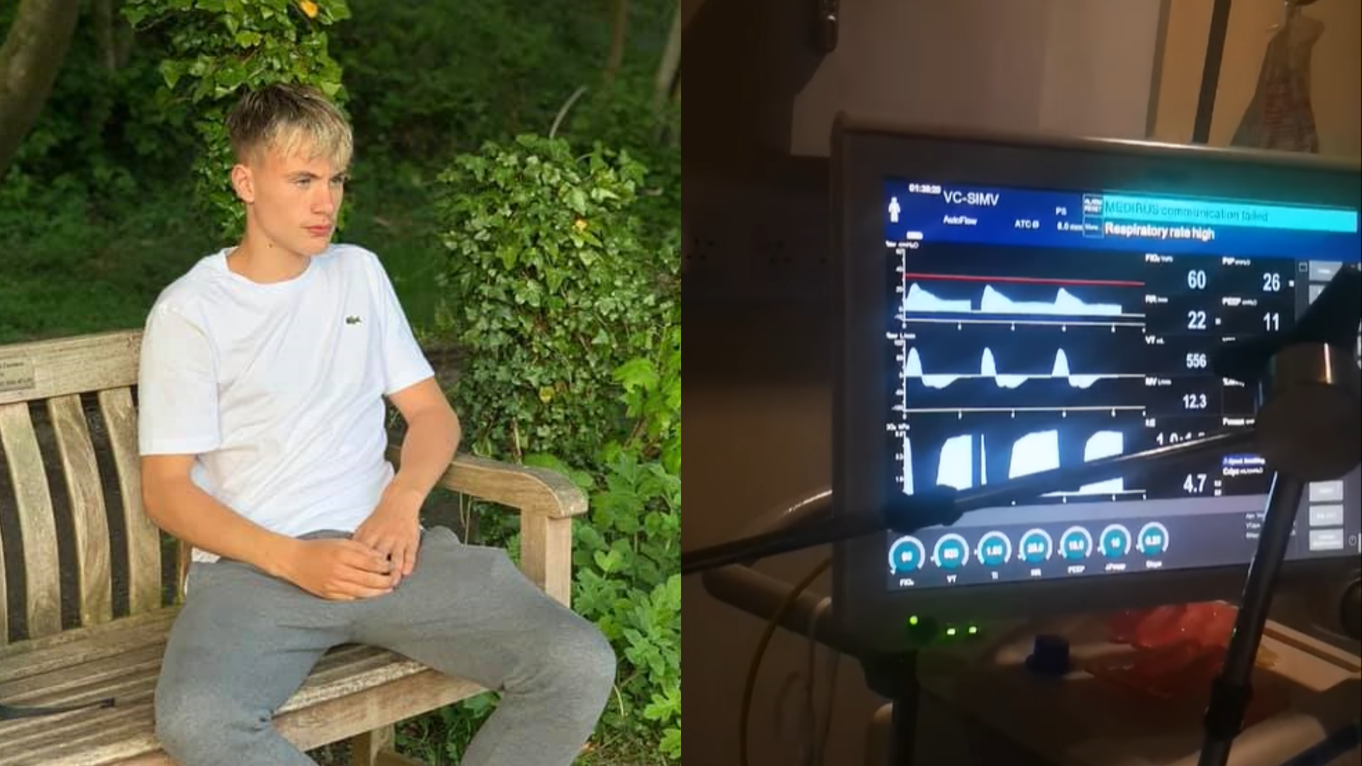 18歲少年車禍送醫被宣告腦死，手術前奇蹟復活。（翻攝自Jade Roberts臉書）