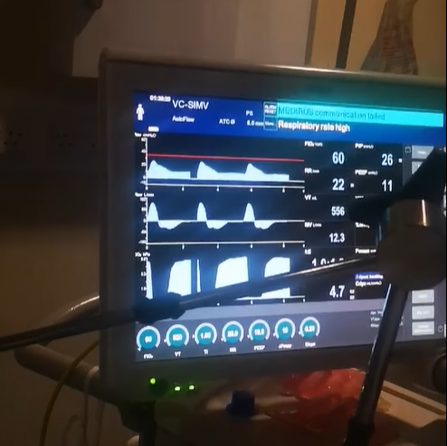路易斯在手術前恢復自行呼吸,家人們見狀相當興奮。(翻攝自Jade Roberts臉書)