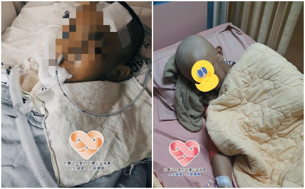 少年小宇癌症復發，治療恐需削除眼骨，他崩潰表示「不想成為只剩半張臉的怪人」。（翻攝自「社團法人愛的延續公益協會」臉書）