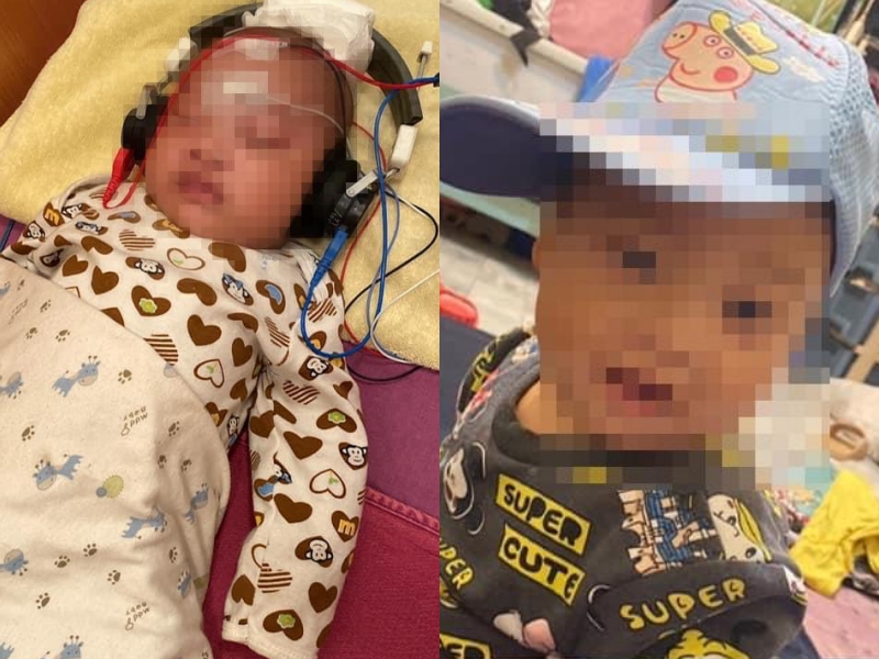 一名媽媽的兒子天生患有「小耳症」，但孩子的聽力與腦部皆正常發展。（翻攝自「靠北婆婆2.0」臉書）