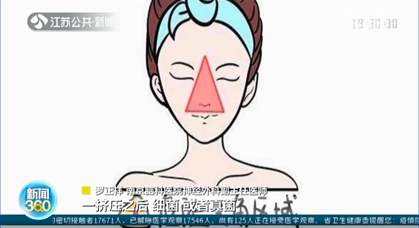 醫生提醒「危險三角區」的痘痘千萬別亂擠。(翻攝自荔枝網)