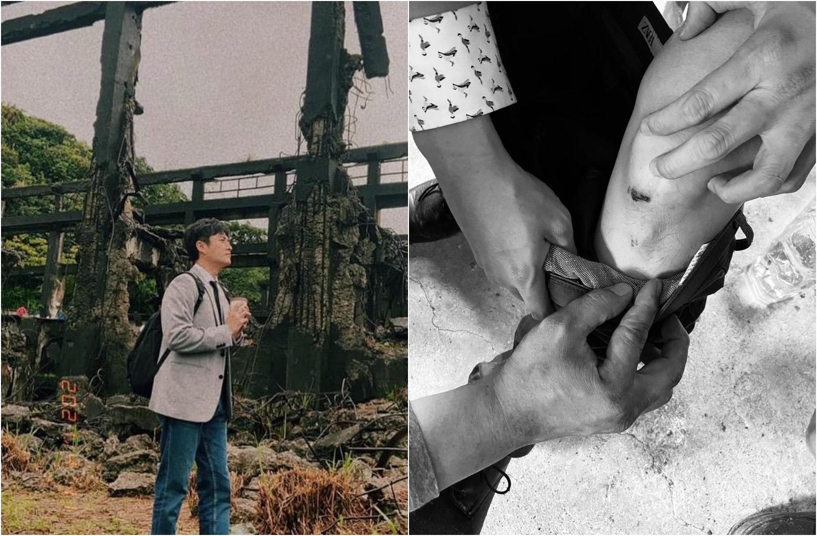 黃靖倫在評估完傷勢後，決定自理，卻不去醫院而被老婆叨念。（翻攝自黃靖倫臉書）