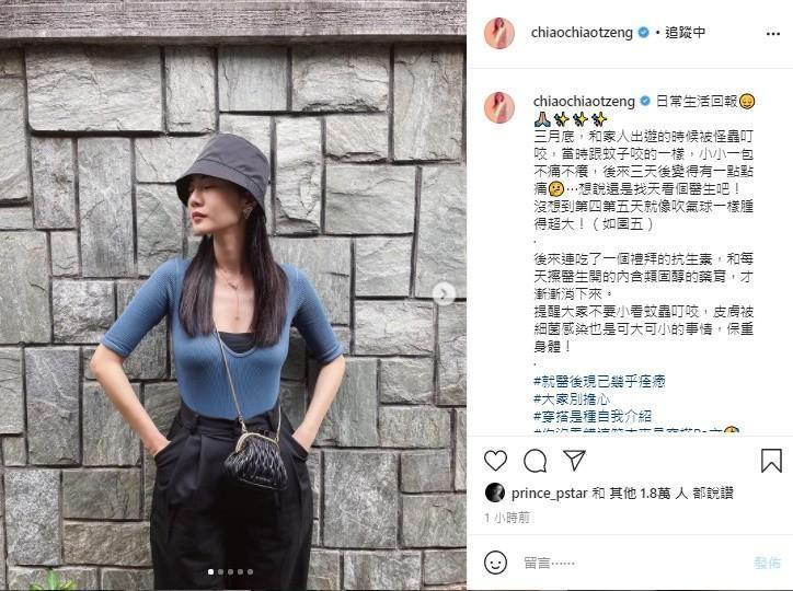 曾之喬和粉絲分享遭到怪蟲叮咬的經驗。(翻攝自曾之喬IG)
