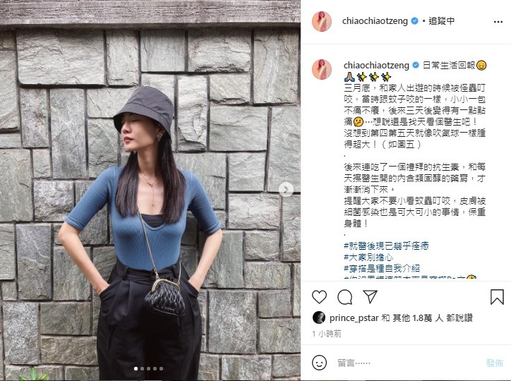 曾之喬和粉絲分享遭到怪蟲叮咬的經驗。（翻攝自曾之喬IG）