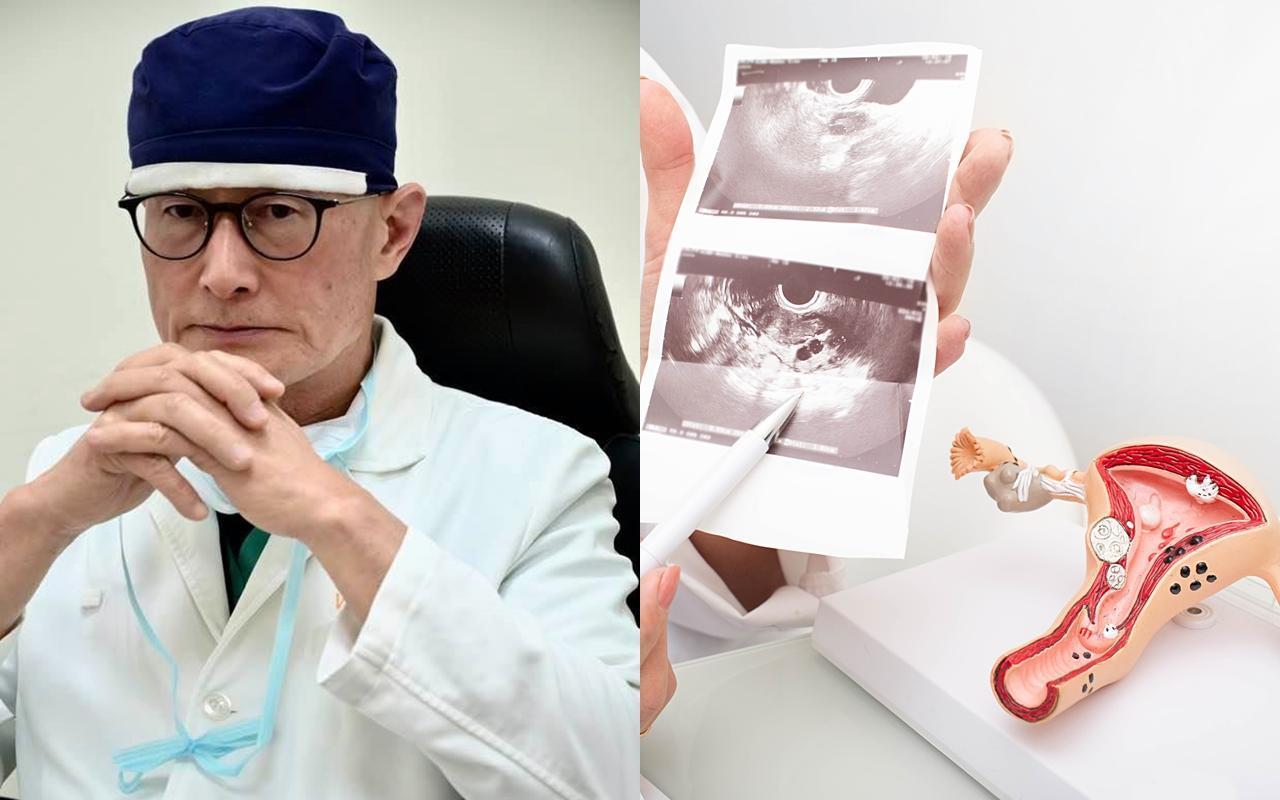 婦產科權威醫師劉偉民(左)遭控未經患者同意就切除其子宮,北檢依過失重傷害罪起訴。(翻攝自劉偉民臉書、右為示意圖,翻攝自東方IC)