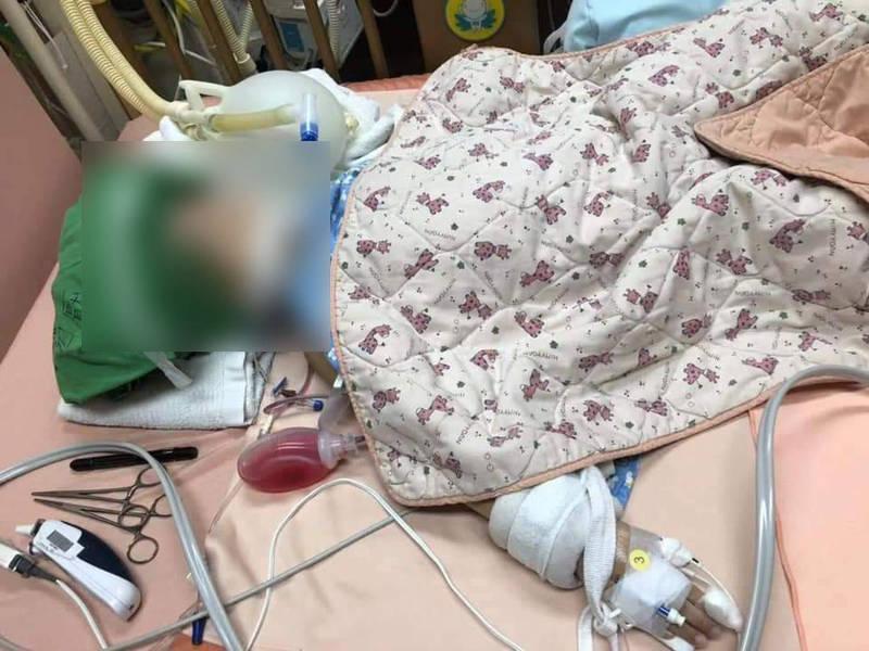 無良保母夫妻施虐,導致5歲女童頭部外傷還,有腦出血的問題,語言能力受到影響,右半邊身體也癱瘓。(讀者提供)