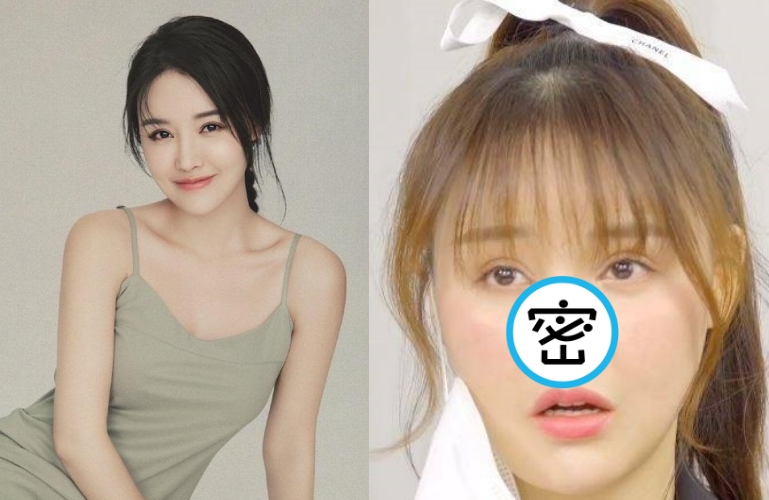 中國大陸女星高溜在整形失敗7個月後，首度揭露復原狀況。 （翻攝自鳳凰網娛樂微博）