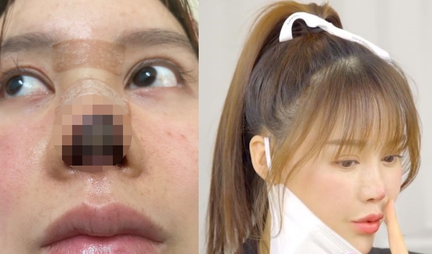 高溜透露過去對自己不夠自信,因此才會有整形的念頭。(翻攝自高溜微博)