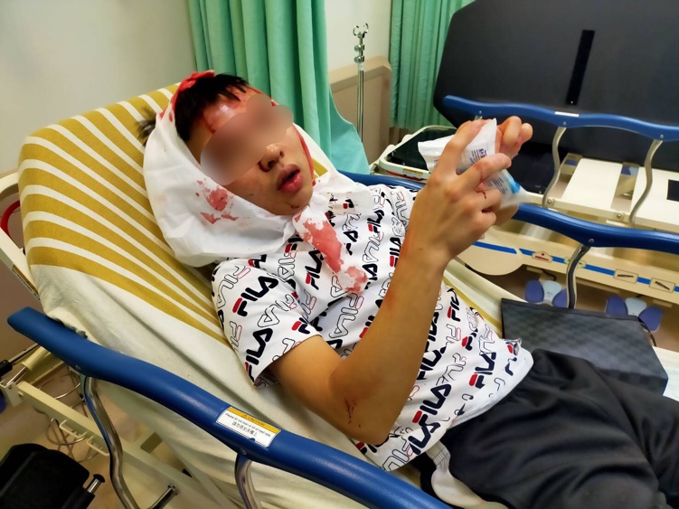 只是奉勸客人要帶口罩,結果土城區清水路萊爾富的店員被打到縫數十針。(翻攝畫面)