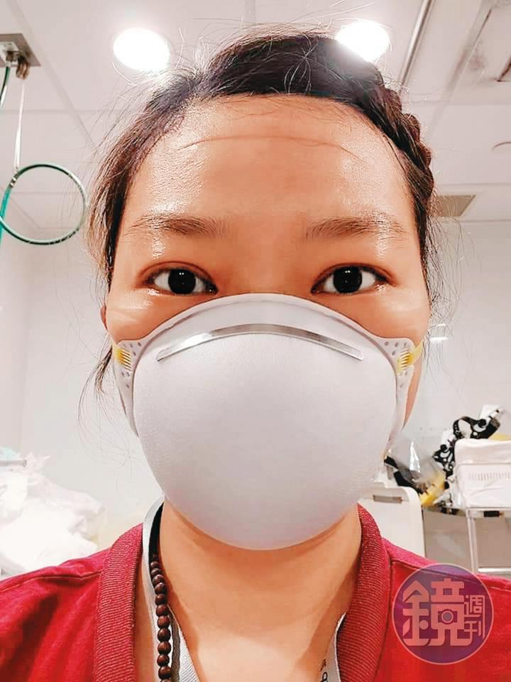 醫護人員全副武裝工作一整天,脫下隔離衣後臉上都是壓痕。(楊卉庭提供)