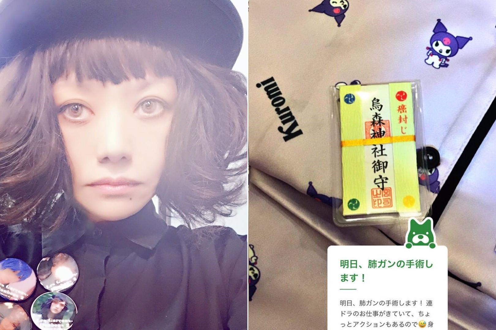 廣田玲央名透露罹患肺癌，為了活下去將接受切除手術。（翻攝自廣田玲央名IG）