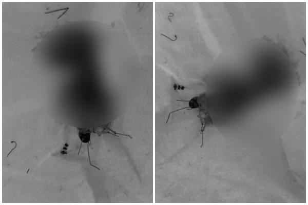 網友打死蟑螂後，竟然噴出「紅色鮮血」，讓他感到十分不解。（翻攝自「爆廢公社公開版」臉書）