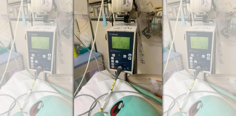 台中一名7歲男童遭教練多次重摔，至今仍昏迷中。（翻攝自男童父親臉書）