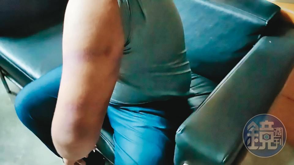 B先生(圖)驗傷後,對蔡姓下士和打人、綽號「龍蝦」的男子提告。