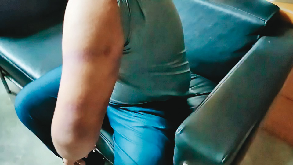 友人B先生（圖）受託取款，竟遭當地角頭埋伏毆打，他驗傷後對蔡姓下士和打人、綽號「龍蝦」的男子提告。