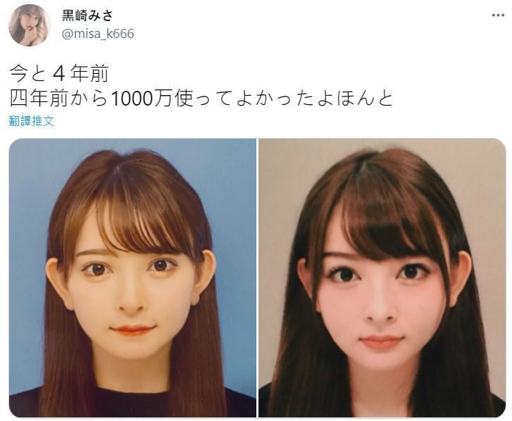 黑崎美紗分享整形前後的大頭照,讓網友們看完全傻眼。(翻攝自黒崎みさ推特)