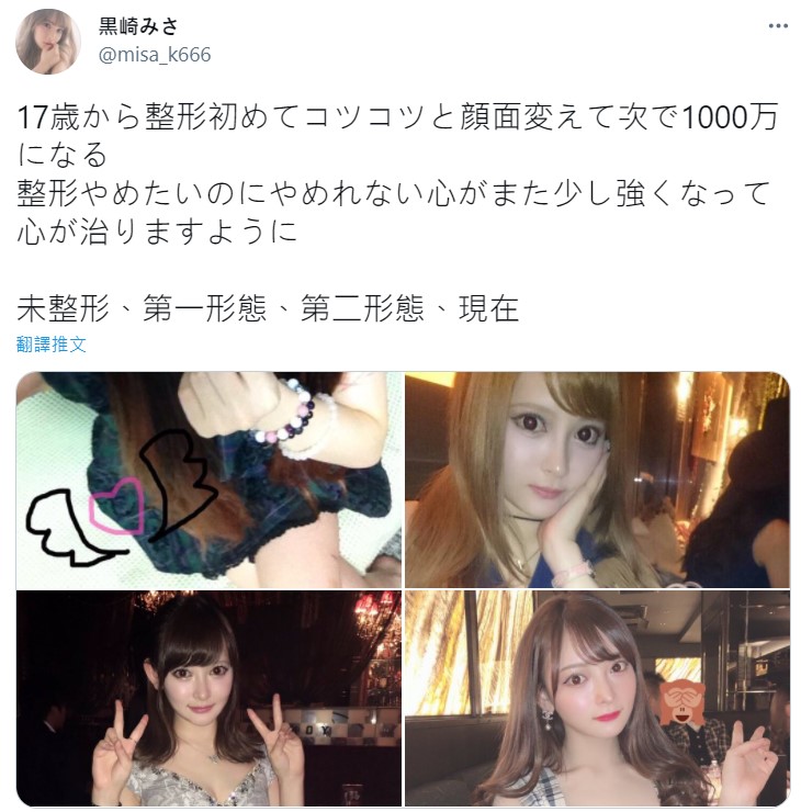 黑崎美紗大方公開自己不同階段整形的照片。(翻攝自黒崎みさ推特)
