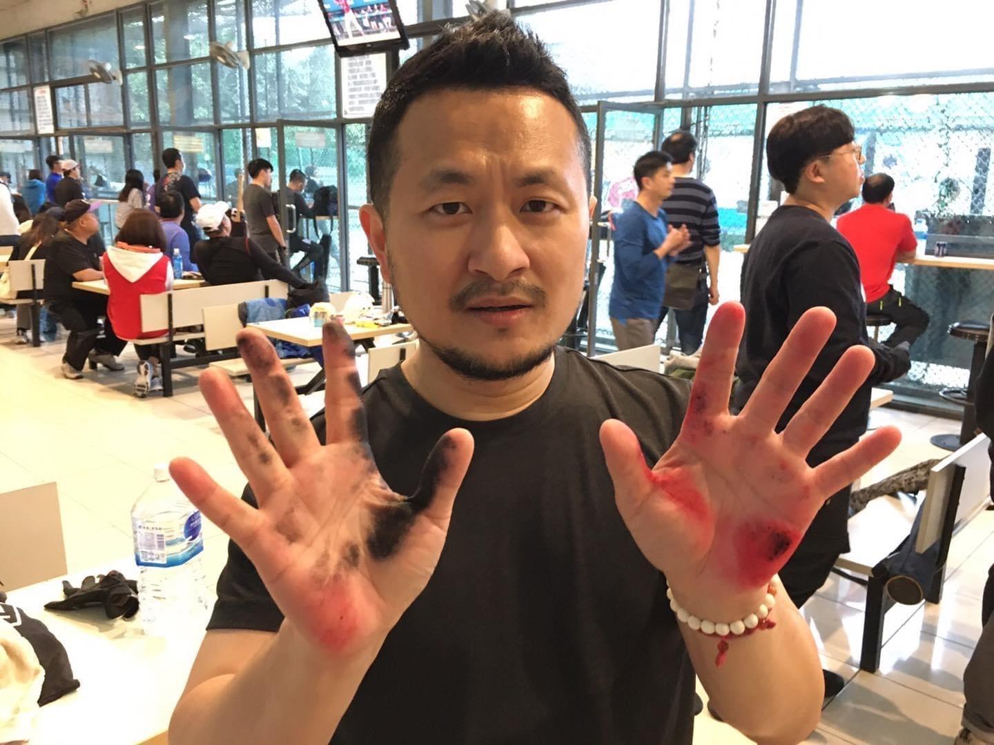 九把刀自願擔任國產疫苗第三階段試驗者。(翻攝自九把刀臉書)