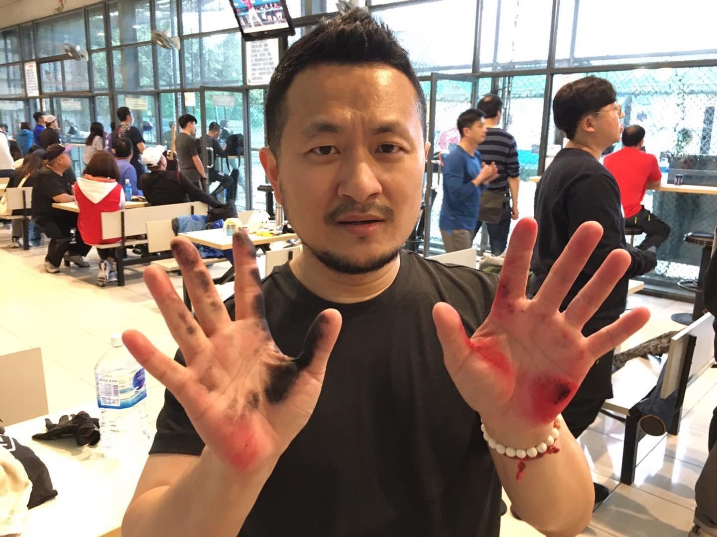 九把刀自願擔任國產疫苗第三階段試驗者。(翻攝自九把刀臉書)