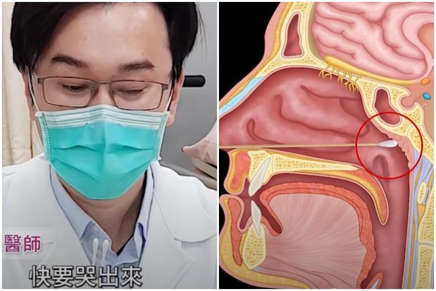 蘇一峰醫師用3分鐘影片示範如何居家快篩。(翻攝自蘇一峰臉書)