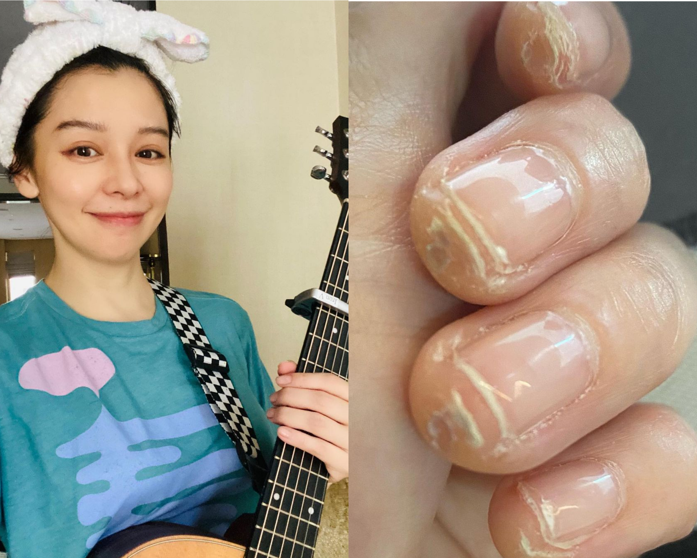徐若瑄彈吉他彈到手指起繭脫皮，粉絲們安慰她是練吉他必經之路，等長了厚厚的肉就能談出好音色。（徐若瑄IG）