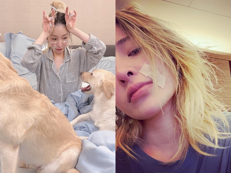 蕭亞軒雖被愛犬「弟弟」咬傷，但她理解狗狗是因腦部出狀況才難以控制行為，因此選擇原諒牠。（翻攝自蕭亞軒臉書）