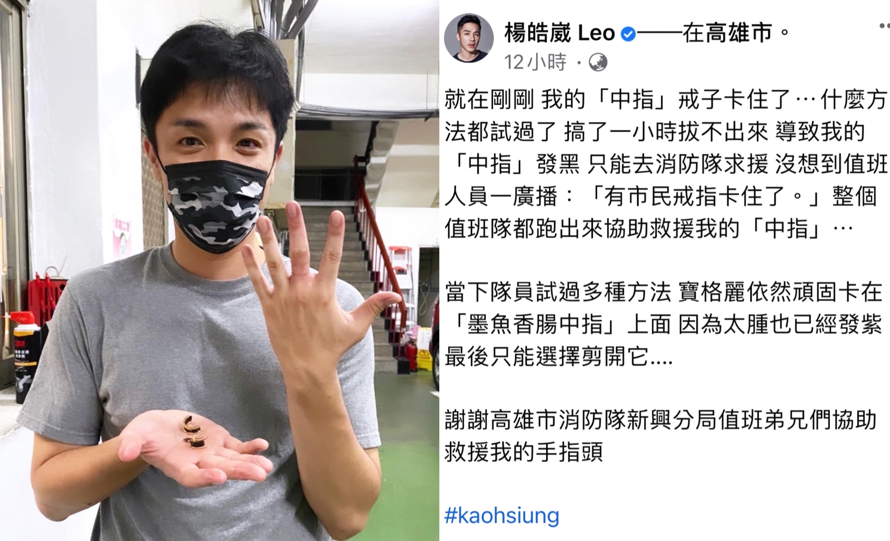 楊皓崴因故戒指卡住中指導致發黑，趕緊找消防隊員幫忙解除截肢危機。（翻攝自楊皓崴臉書）