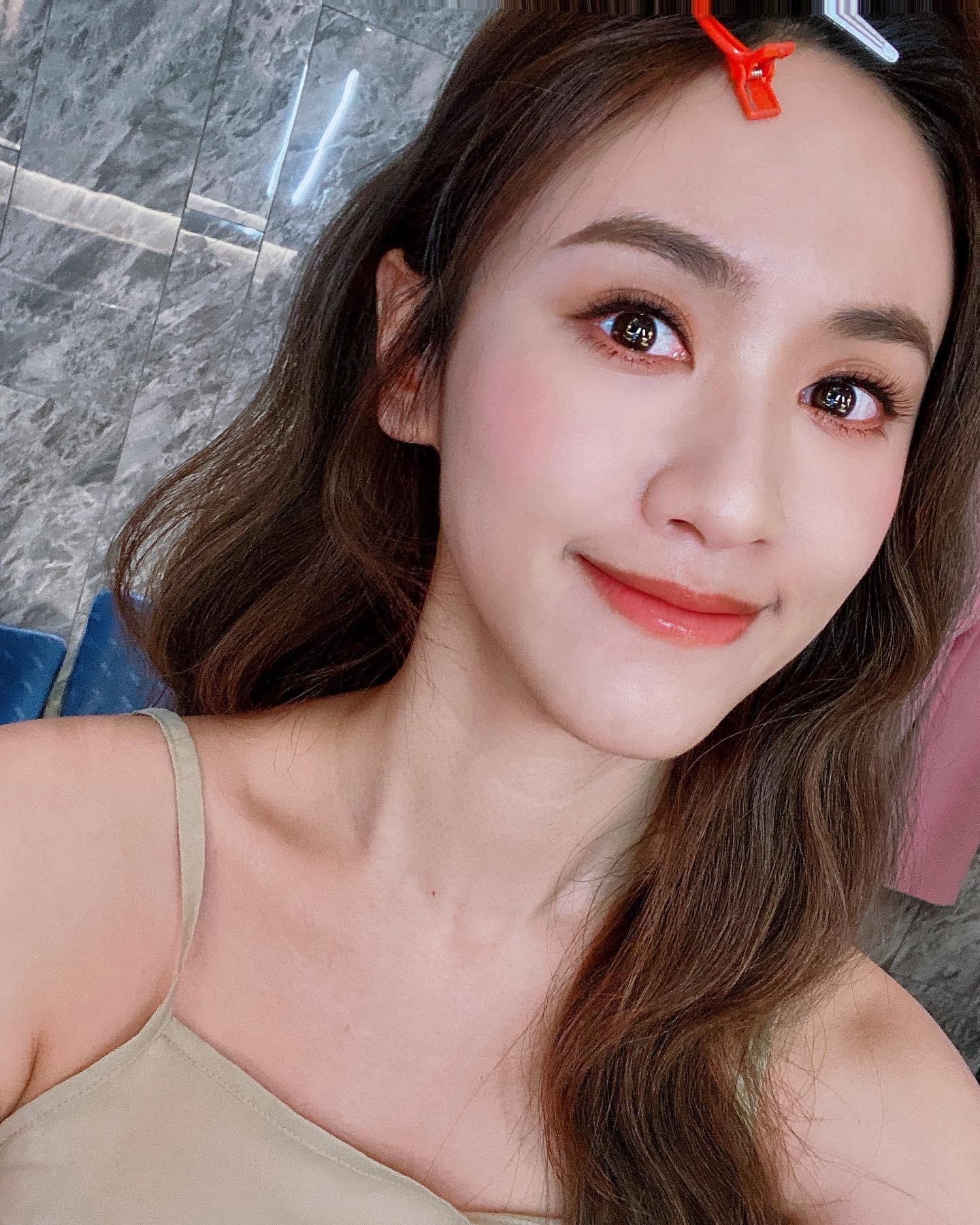 吳姍儒左肩重現疑似瘀青的暗影，被網友開玩笑問「被家暴？」。（翻攝自吳姍儒IG）