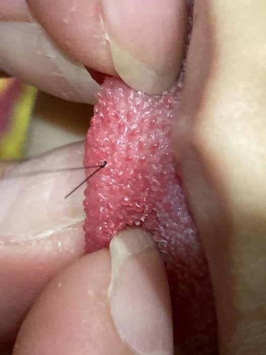 原PO發現小姪女舌頭上竟纏繞著頭髮，網友們紛紛要原PO趕緊將小姪女送醫。（翻攝自臉書社團「爆廢公社二館」）