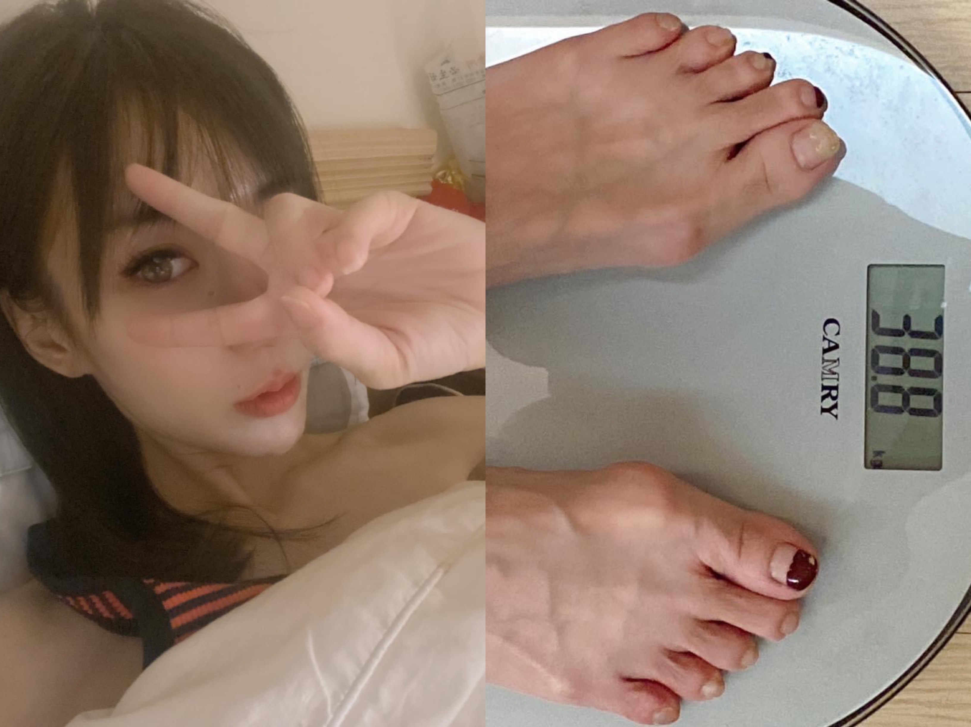 羅巧倫施打完第一劑AZ疫苗後產生全身痠痛，食欲不佳狀況，3天後體重掉剩38.8公斤。（翻攝自羅巧倫臉書）