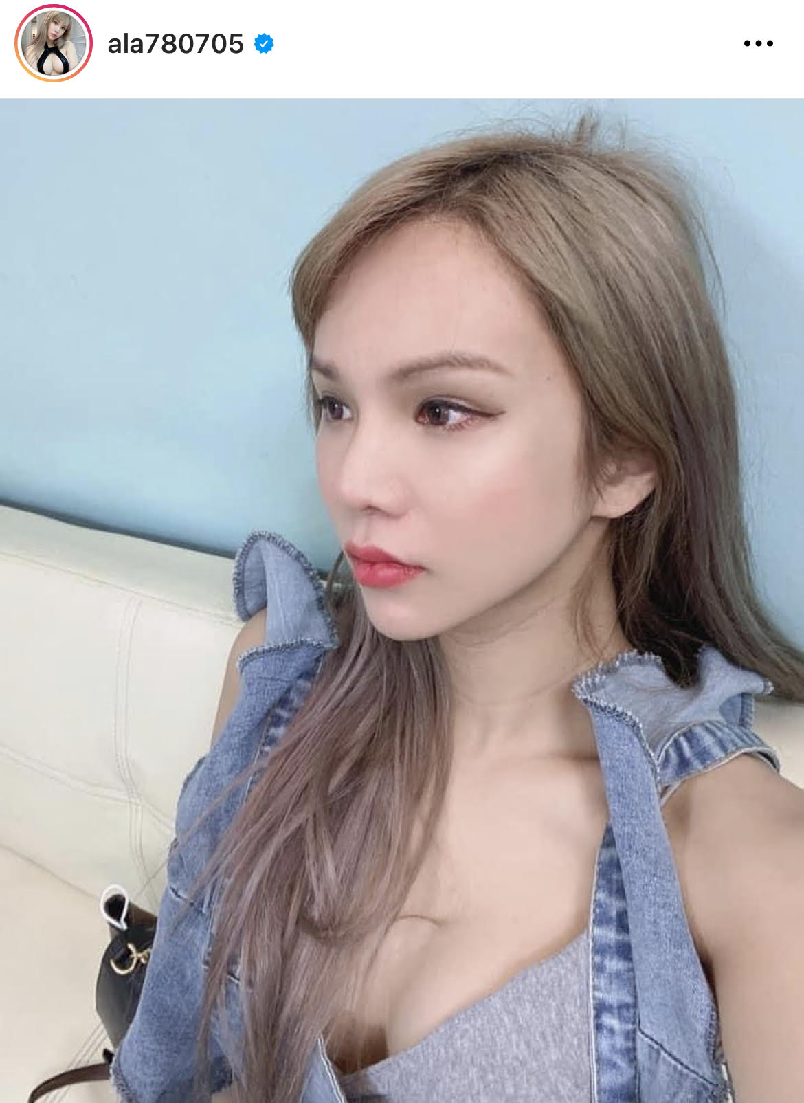 小A辣瘋迷整形。（翻攝自小A辣IG）