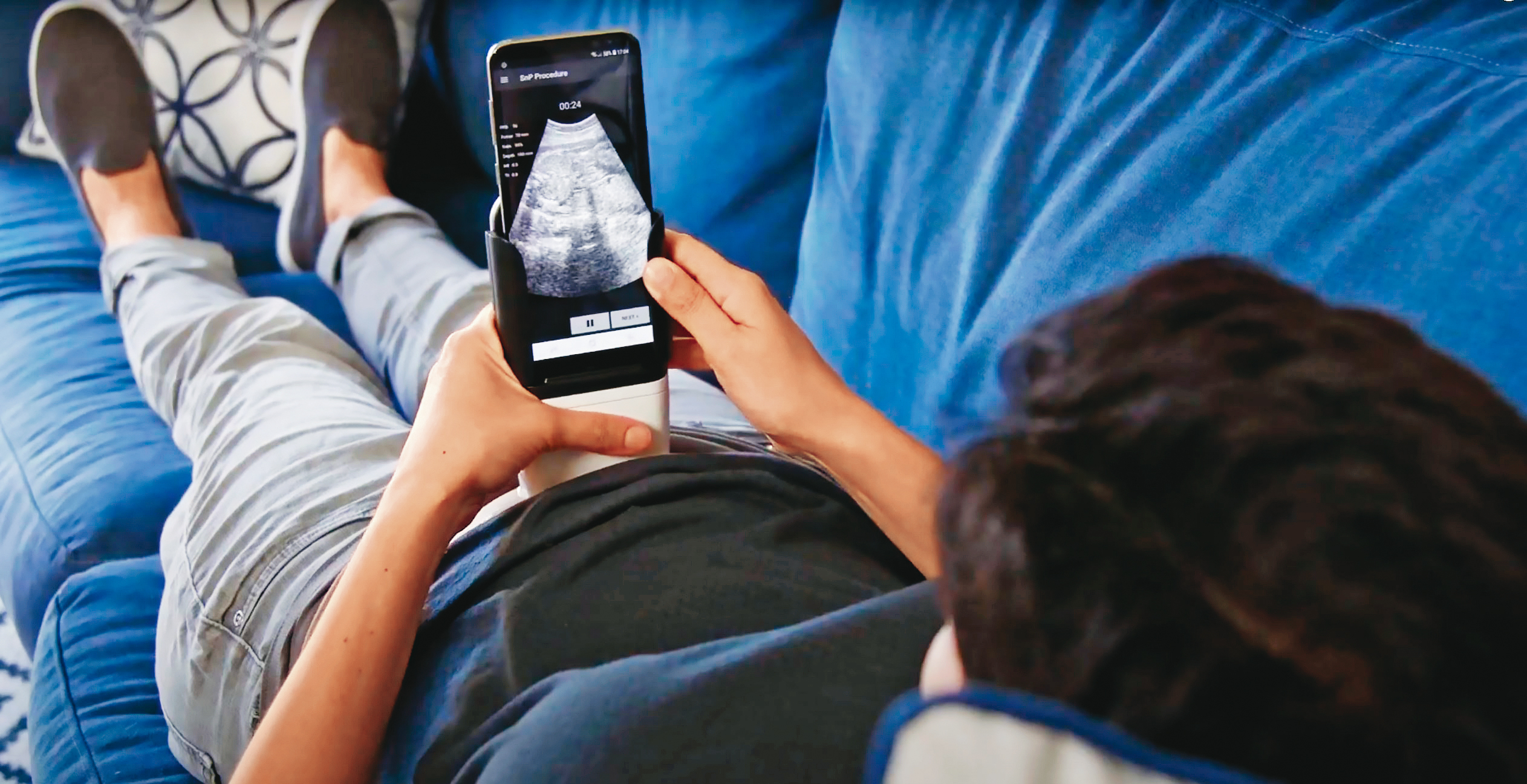 以色列新創公司PulseNmore研發出家用手持式超音波系統，進攻遠端懷孕醫療超音波監測領域。（東方IC）