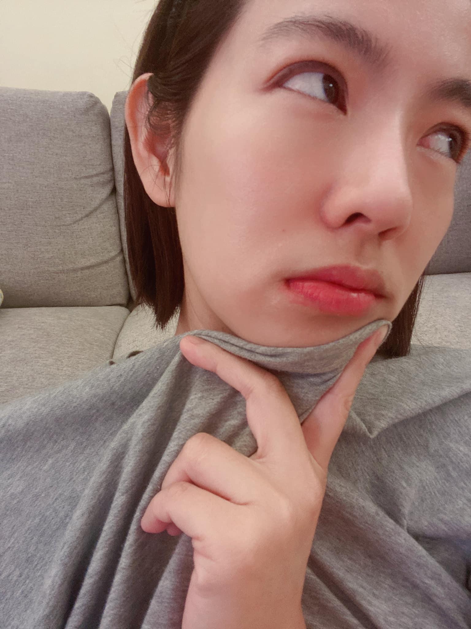 米可白生魚片吃到嘴唇發腫，因為只腫左邊，所以她一點都不覺得性感。（翻攝米可白臉書）