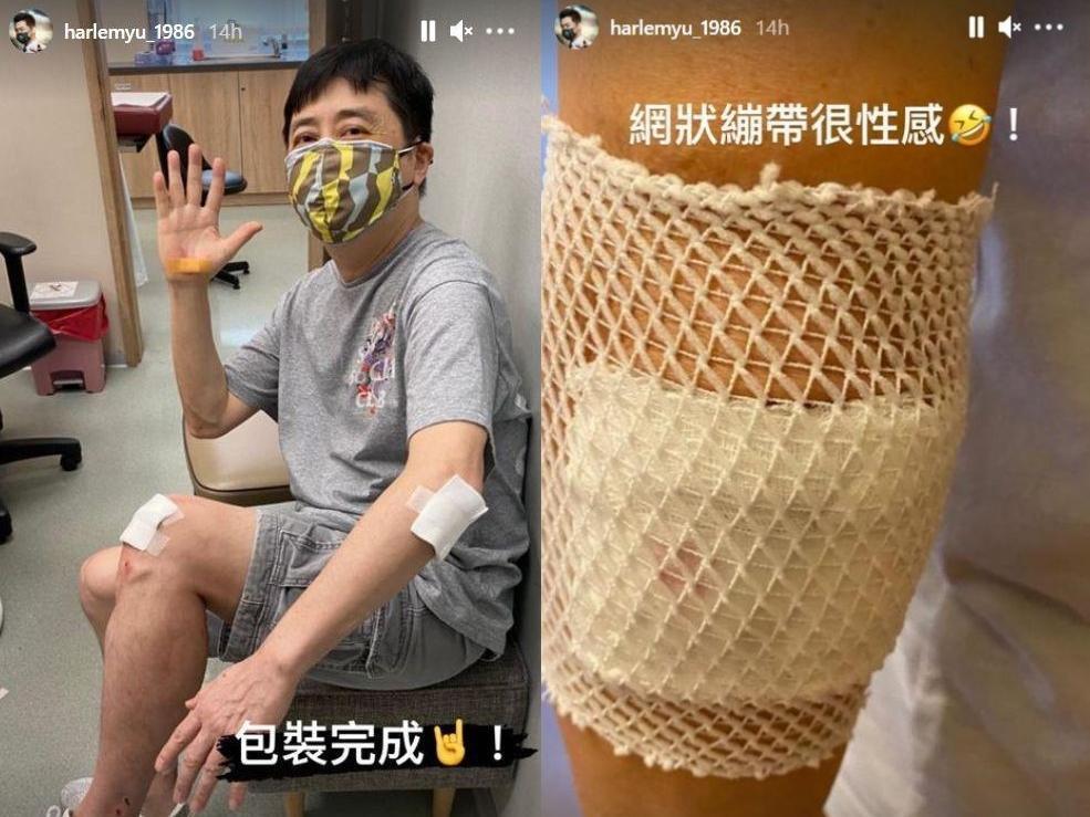哈林騎車受傷,讓粉絲及朋友們都嚇壞了。(翻攝自哈林IG)