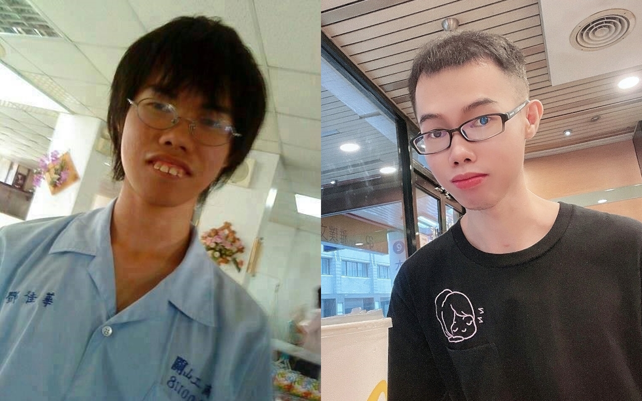 鄧佳華昨天透露，有牙醫師提出半價贊助牙齒矯正手術，消息曝光引發網友熱議。（翻攝自鄧佳華臉書）