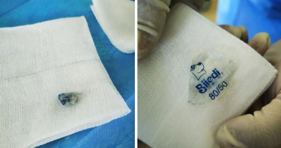 師研判應該是貼在衣服上的標籤被寶寶吃進肚子裡。(翻攝網易新聞)