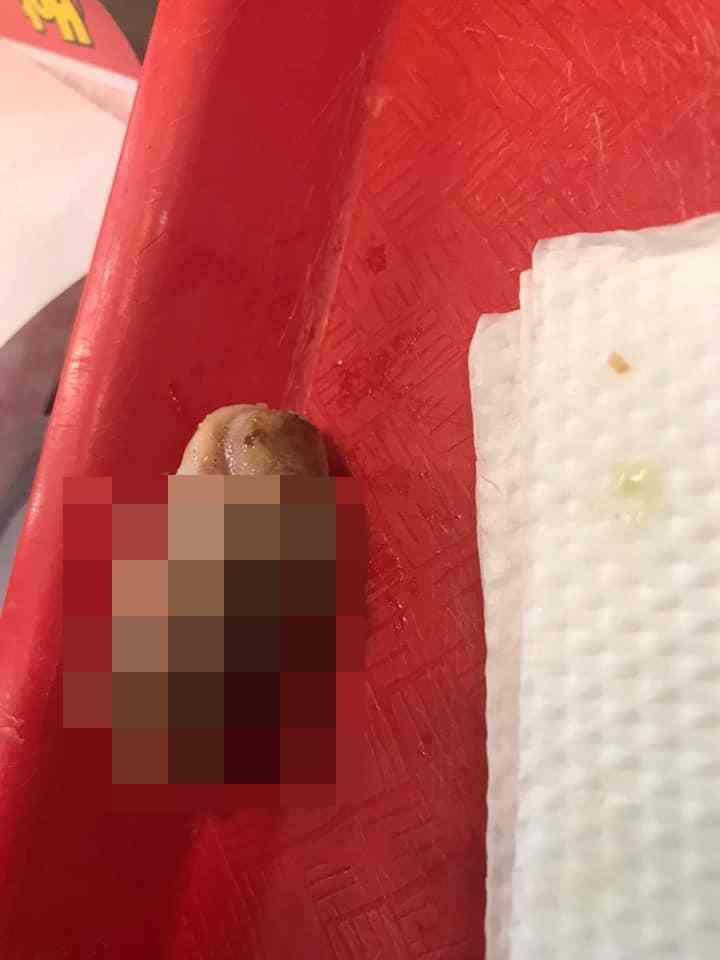 玻利維亞一名女子到速食店吃漢堡,沒想到竟吃到人類手指。(翻攝自Estefany Benitez臉書)