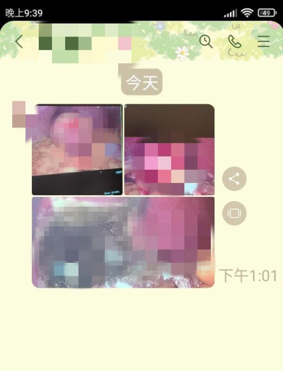 長輩改LINE傳手術照,原PO無奈「還一口氣傳了三張照片,晚餐差點沒吐出來」。(翻攝「爆怨公社」)