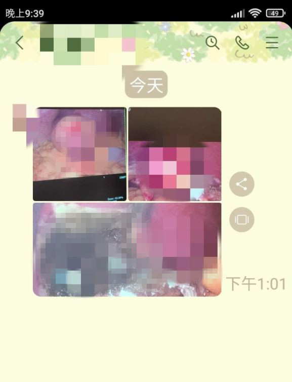 長輩改LINE傳手術照，原PO無奈「還一口氣傳了三張照片，晚餐差點沒吐出來」。（翻攝「爆怨公社」）