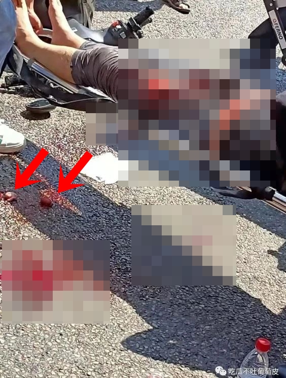 雖然機車騎士意識相當清醒，卻疑似因猛烈撞擊導致睪丸噴出。（翻攝自微博）