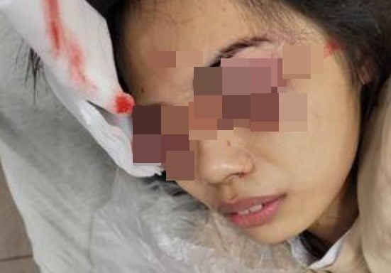 受害女店員雙眼重傷，星期六將進行第二次手術。（翻攝爆料公社）