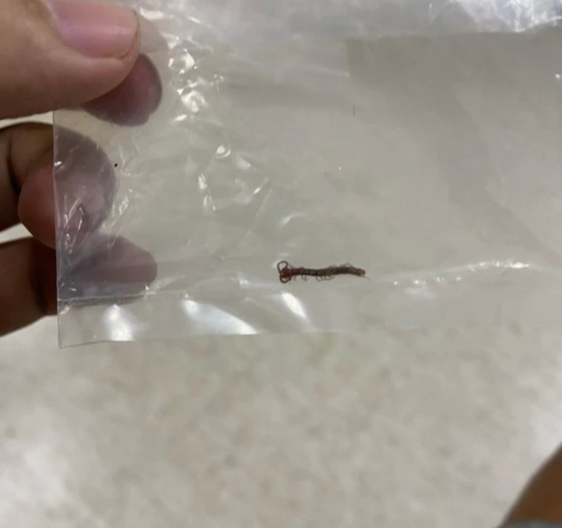 葉男裸睡慘遭2公分長的蜈蚣啃咬下體，右睪丸紅腫疼痛。（翻攝畫面）