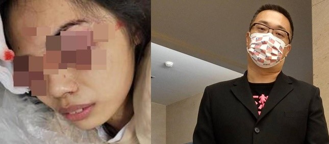 屏東一名超商女店員（左）日前遭一名男子徒手挖眼，而宅神朱學恒（右）破例公開女店員帳戶，希望大家能夠幫忙她一起度過難關。（左，翻攝爆料公社，右，翻攝朱學恒臉書）