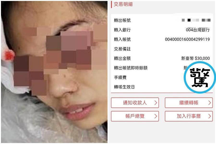 屏東縣一名19歲超商女店員因勸導男子應戴好口罩,慘遭楊姓男子殘忍挖眼,網友掀起捐款潮。(翻攝自翻攝爆料公社、PTT)