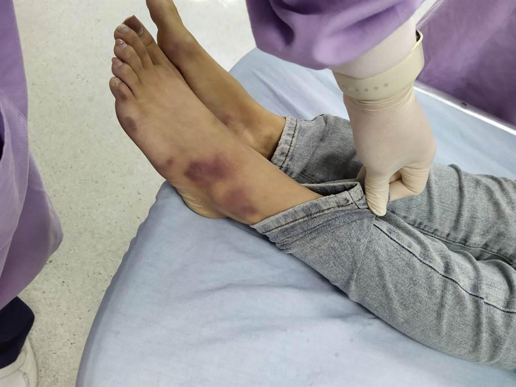 與陳修將一同入住摩鐵多日的22歲胡姓女子全身多處傷痕累累，送到彰化醫院前即已沒有生命跡象，搶救後仍宣告不治。（翻攝畫面）